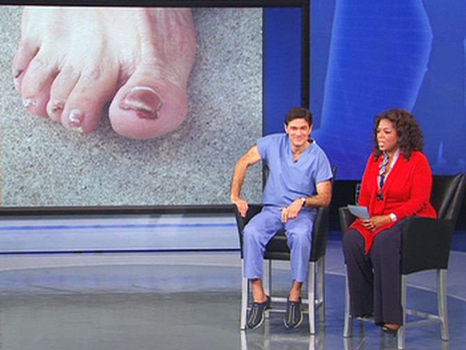 Geri talks about her foot fungus.