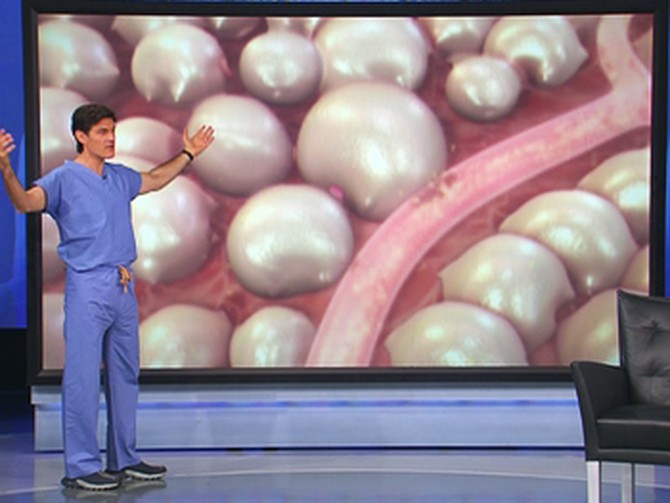 Dr. Oz shows how cellulite forms.