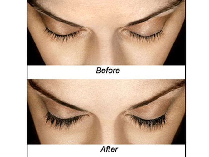 Allergan's Latisse lash growth before and after
