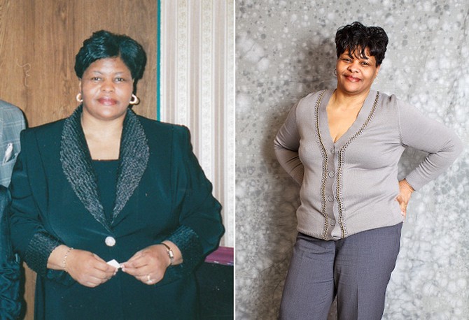 Vera, before and after losing weight
