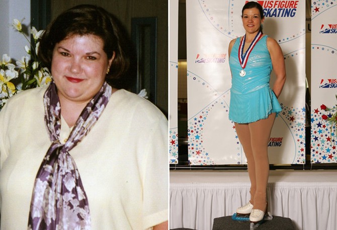 Sandra before and after losing 106 pounds