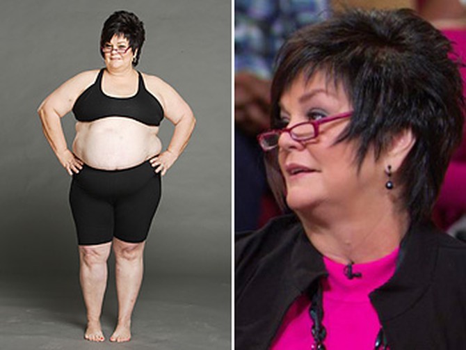 Bette Sue, before and after losing weight