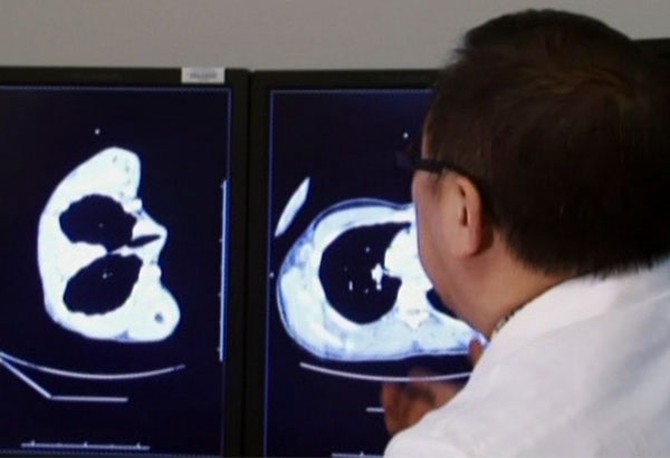 Doctor looks at CT scans