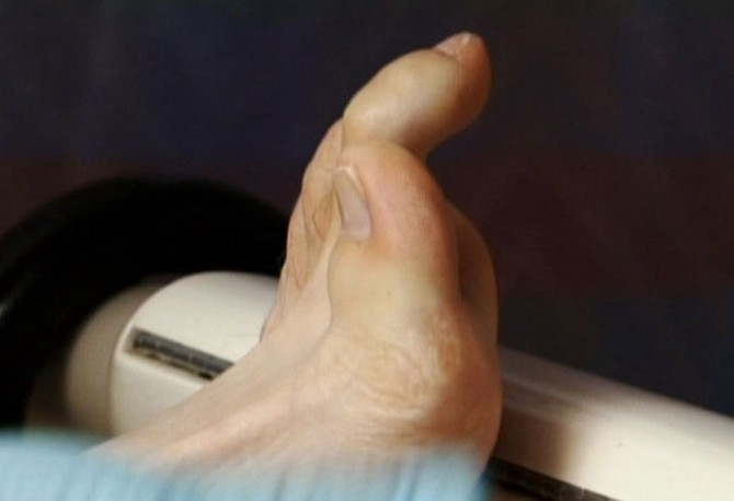 Matt Horick's toes