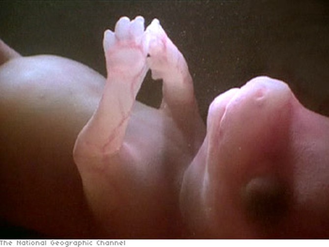 Inside a dog's womb