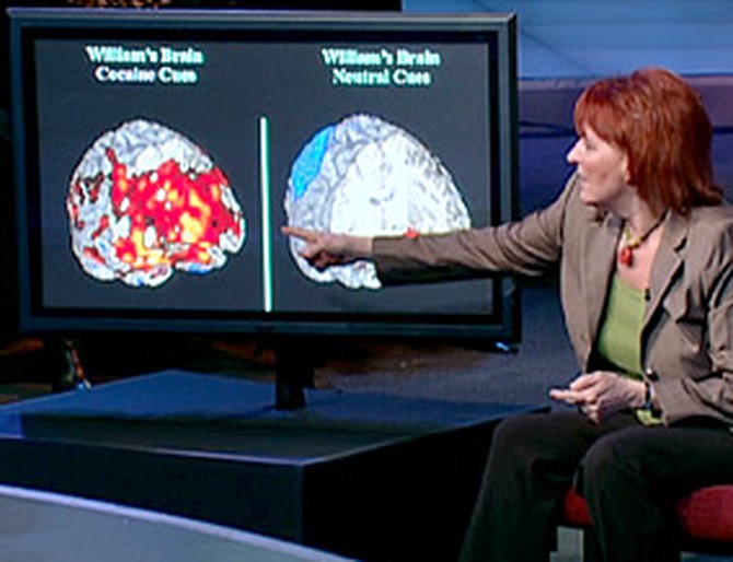 Dr. Childress shows photos of William's brain.