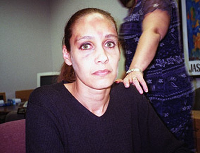 Police officers photograph Susan's bruises.