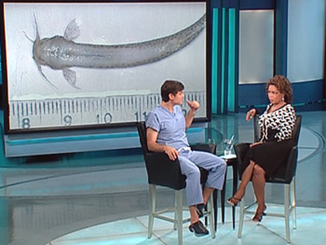 Dr. Oz says the 'penis fish' must be removed surgically.