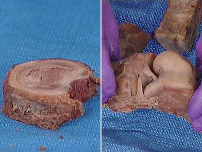 A portion of an unhealthy spine and an unhealthy knee