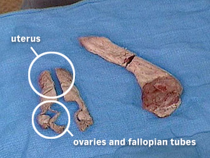 Uterus and penis